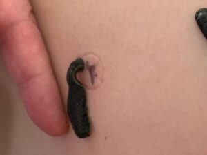 Een bloedzuiger plaatst zijn zuignap op de gemarkeerde plek.